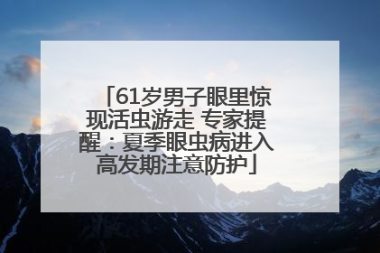 61岁男子眼里惊现活虫游走 专家提醒：夏季眼虫病进入高发期注意防护